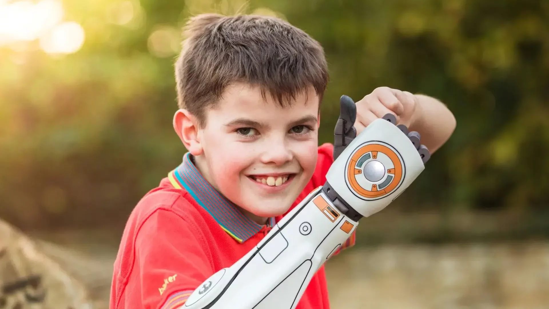 Enfant portant une prothèse bionique Open Bionics inspirée de Star Wars, innovation medtech pédiatrique