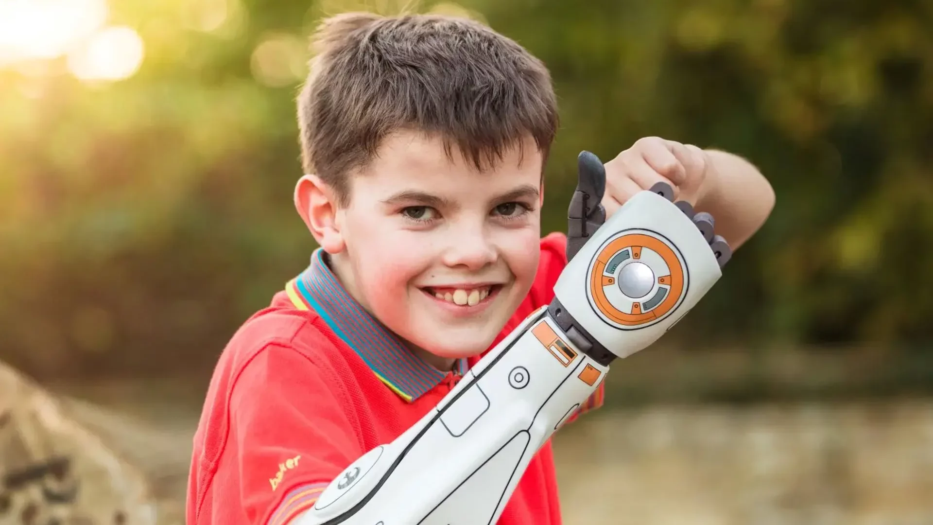 Child wearing an Open Bionics bionic prosthesis inspired by Star Wars, one of medtech's pediatric medical devices